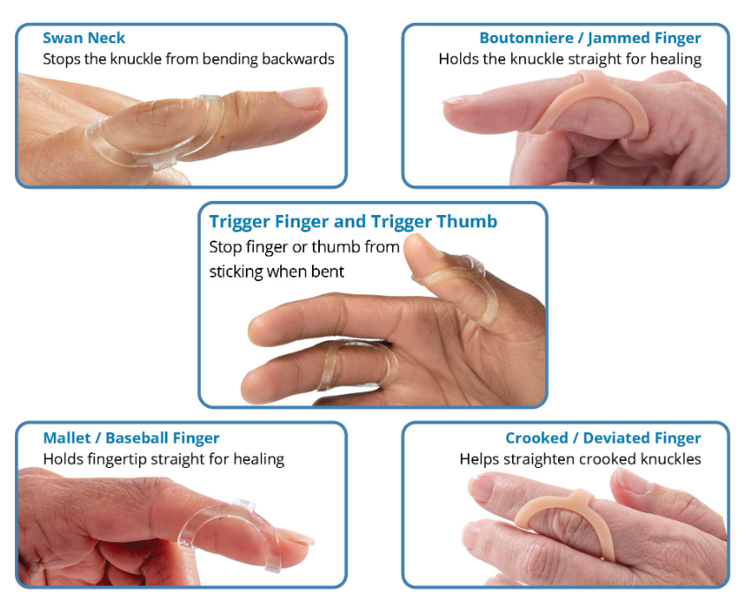 Mynd Oval-8 fingur spelka