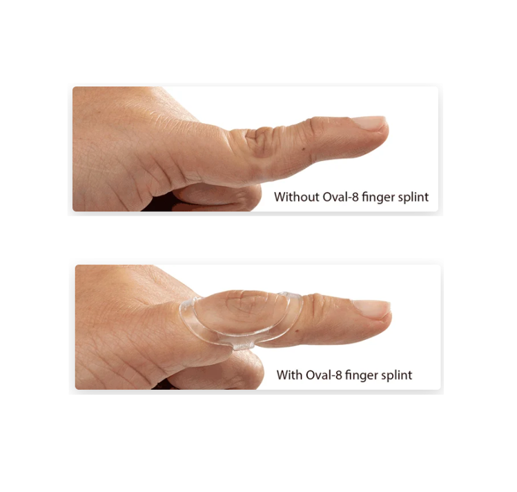 Mynd Oval-8 fingur spelka
